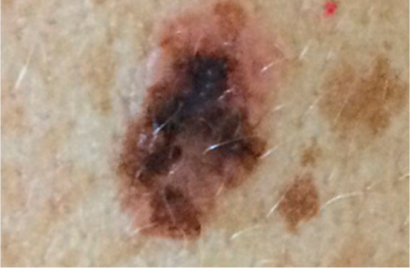 tab image1